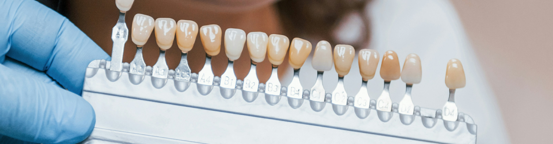 Tooth shade-matching tool next to woman's smile.